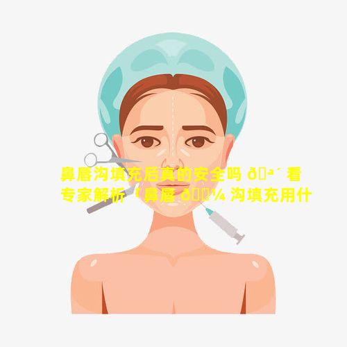 鼻唇沟填充后真的安全吗 🪴 看专家解析「鼻唇 🌼 沟填充用什么玻尿酸最好」